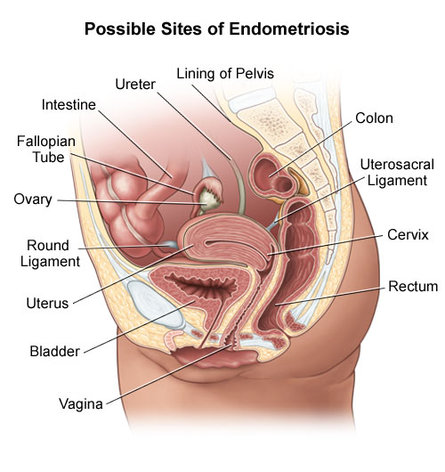 Menstrual cramps anus pain Menstrual cramps anus pain consider, that