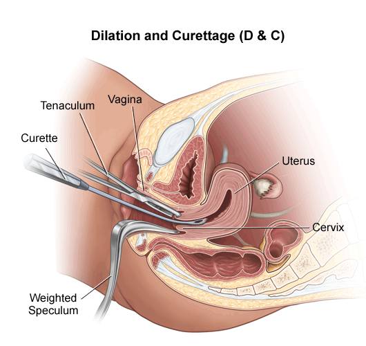 Sex after d and c pics 1