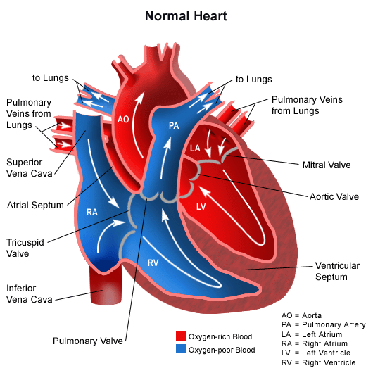 Tetralogy of Fallot