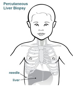 Percutaneous Liver Biopsy