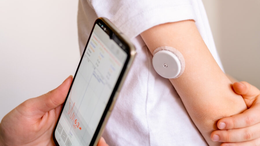 continuous glucose monitoring device on a child’s arm