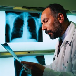 Fotografía de un radiólogo leyendo unos rayos X