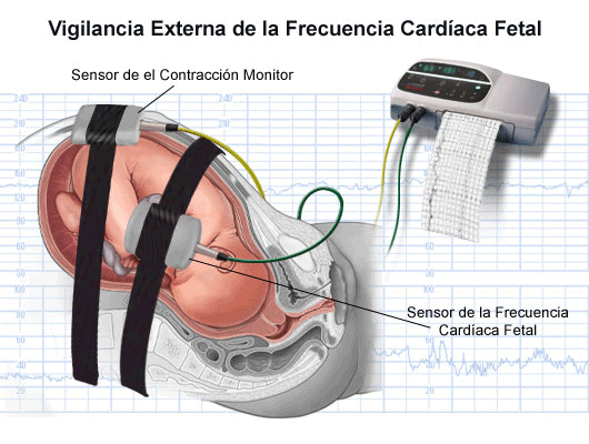 El latido fetal