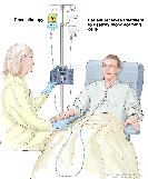 Drawing of a health care provider giving a patient treatment to kill blood-forming cells. Chemotherapy is given to the patient through a catheter in the chest.