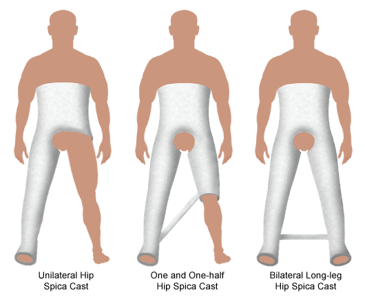 cast types and maintenance