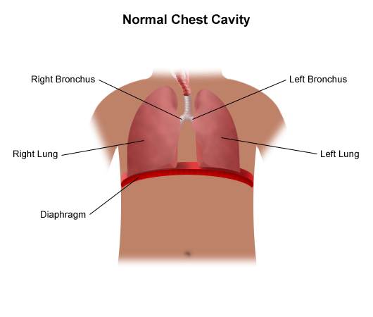 diaphragmatic hernia where is the diaphragm