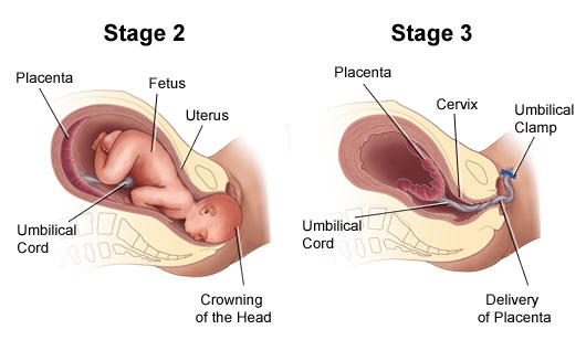 Phases Of Labor Chart