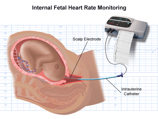 baby head heart monitor