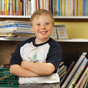 down syndrome trisomy 21