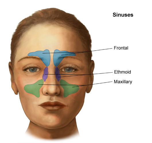 Facial sinusitis cysts information