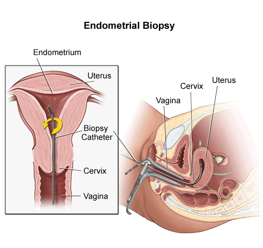 bone marrow biopsy procedure pdf