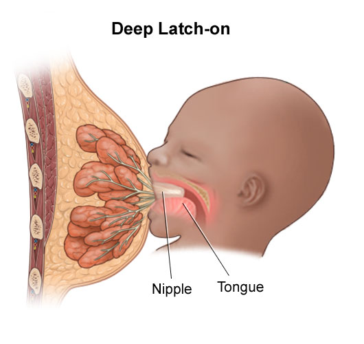 Breast Infections And Inflammations