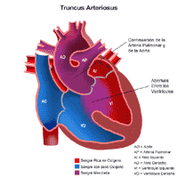 Anatomía de un corazón con una tronco arterioso