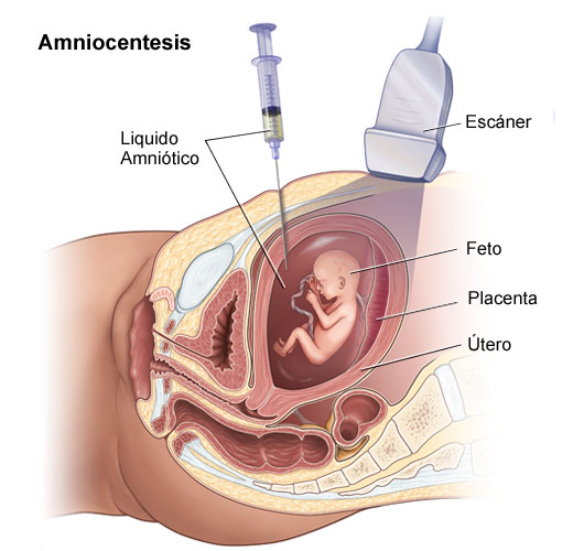 Qué es el latido fetal: el signo de confirmación que marca un antes y un  después para el embarazo