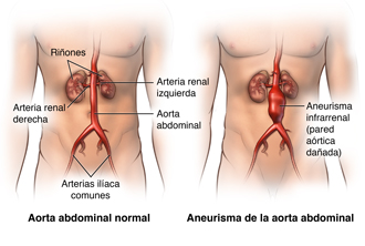 Ubicación de la aorta y las arterias en el cuerpo humano
