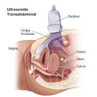 Ilustración de un procedimiento de ecografía transabdominal