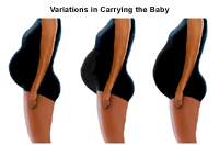 Illustration, die die Variationen des Tragens eines ungeborenen Babys demonstriert