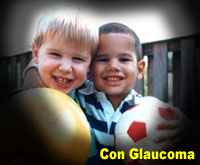 Simulación fotográfica: glaucoma