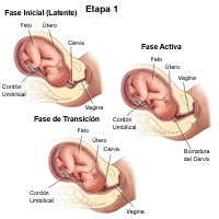 Haga clic en la imagen para ampliarla Demuestra la etapa 1 del trabajo de parto
