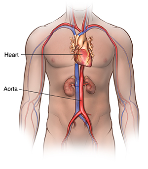 Normal abdominal aorta. Front view of body showing location of heart and aorta.