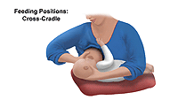 Click Image to Enlarge Illustration of breastfeeding, cross-cradle position
