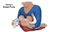 Click Image to Enlarge Illustration demonstrating the use of a breast pump