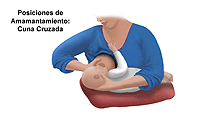 Haga clic en la imagen para ampliarla. Ilustración de la posición de cuna cruzada para amamantar