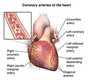 Haga clic en la imagen para ampliarla Imagen que muestra la parte exterior del corazón y las arterias coronarias