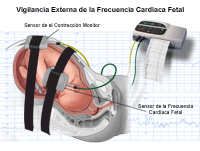 haga clic en la imagen para agrandar texto