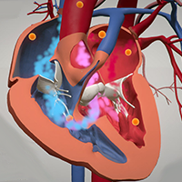 3-D Heart Animation - Stanford Medicine Children's Health